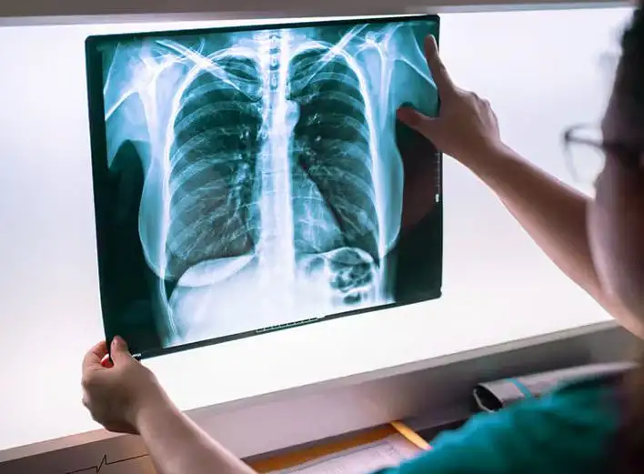 Can an X-Ray Show Cancer? A Complete Guide to Detection, Limits