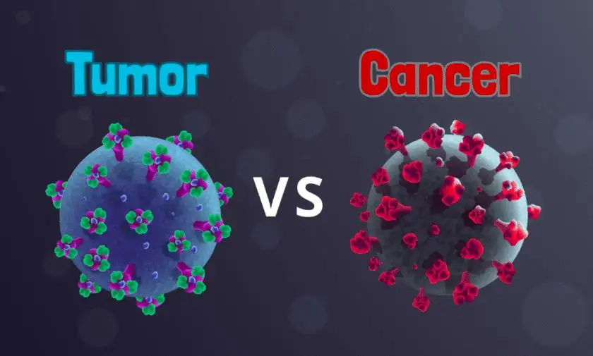 The Difference Between Cancer and Tumors: The Complete Guide