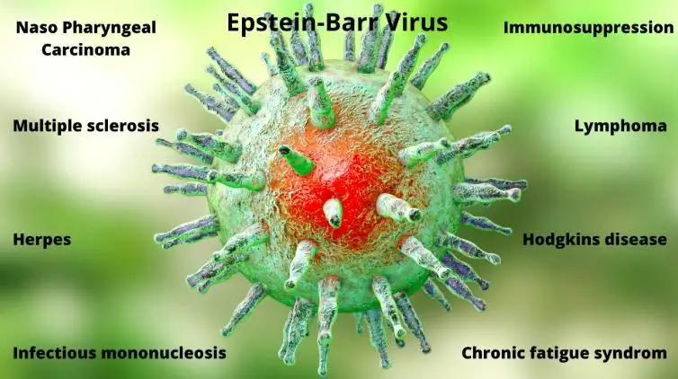 Epstein Barr Virus and Cancer: Understanding the Link, Risks, Symptoms