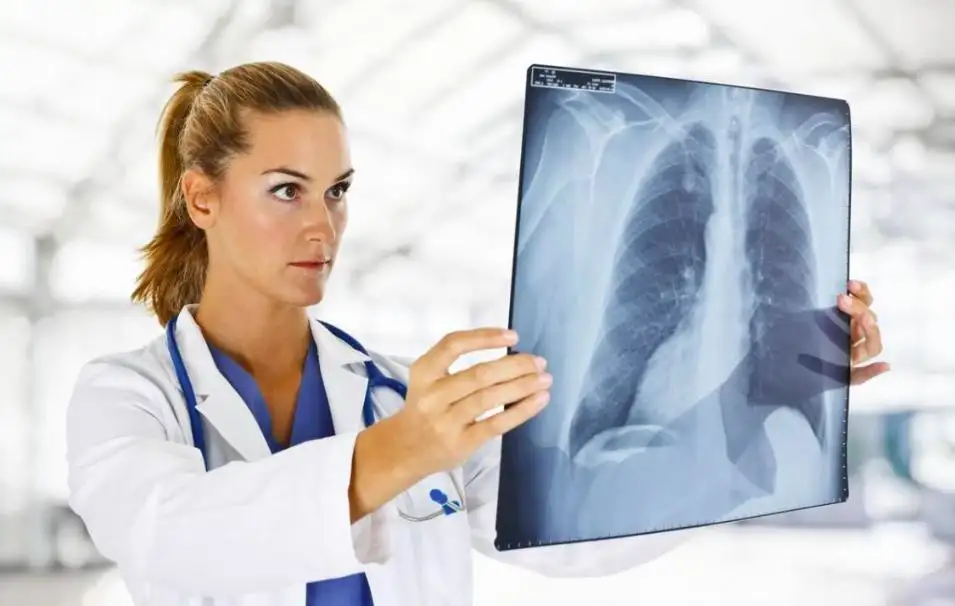 How Long Can You Live With Lung Cancer Without Treatment?