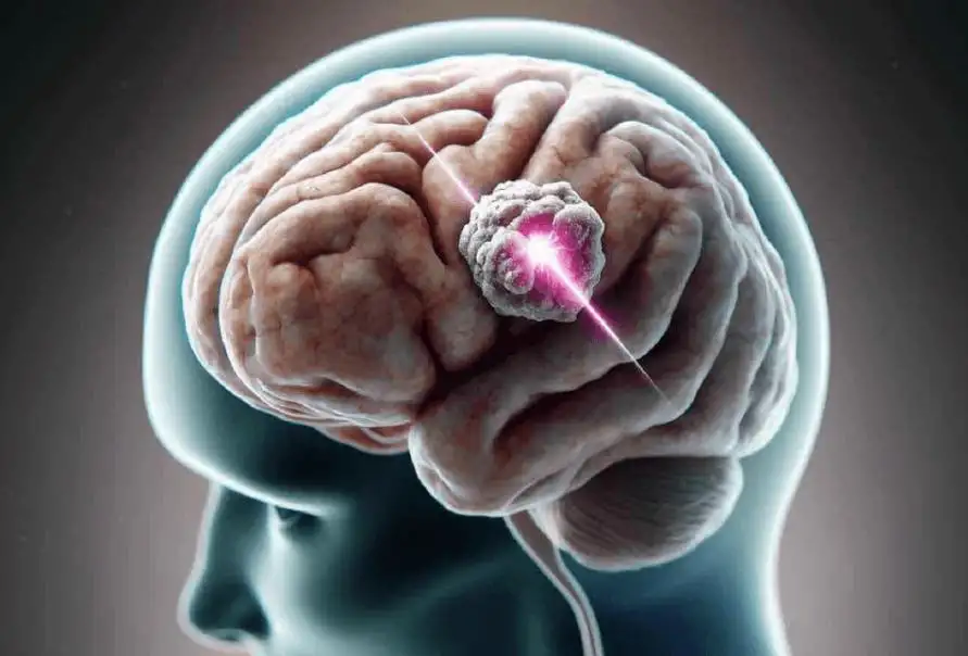 How to Shrink a Brain Tumor Naturally: A Comprehensive Guide