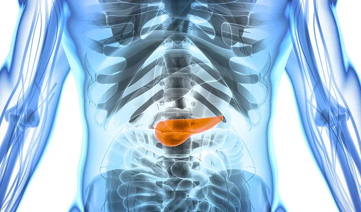 Why Is Pancreatic Cancer So Deadly? A Comprehensive Guide