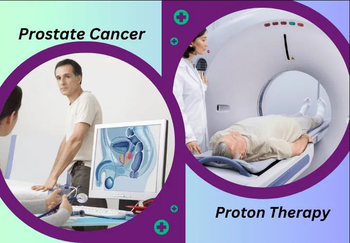 Proton Therapy for Prostate Cancer: Causes and Risk Factors