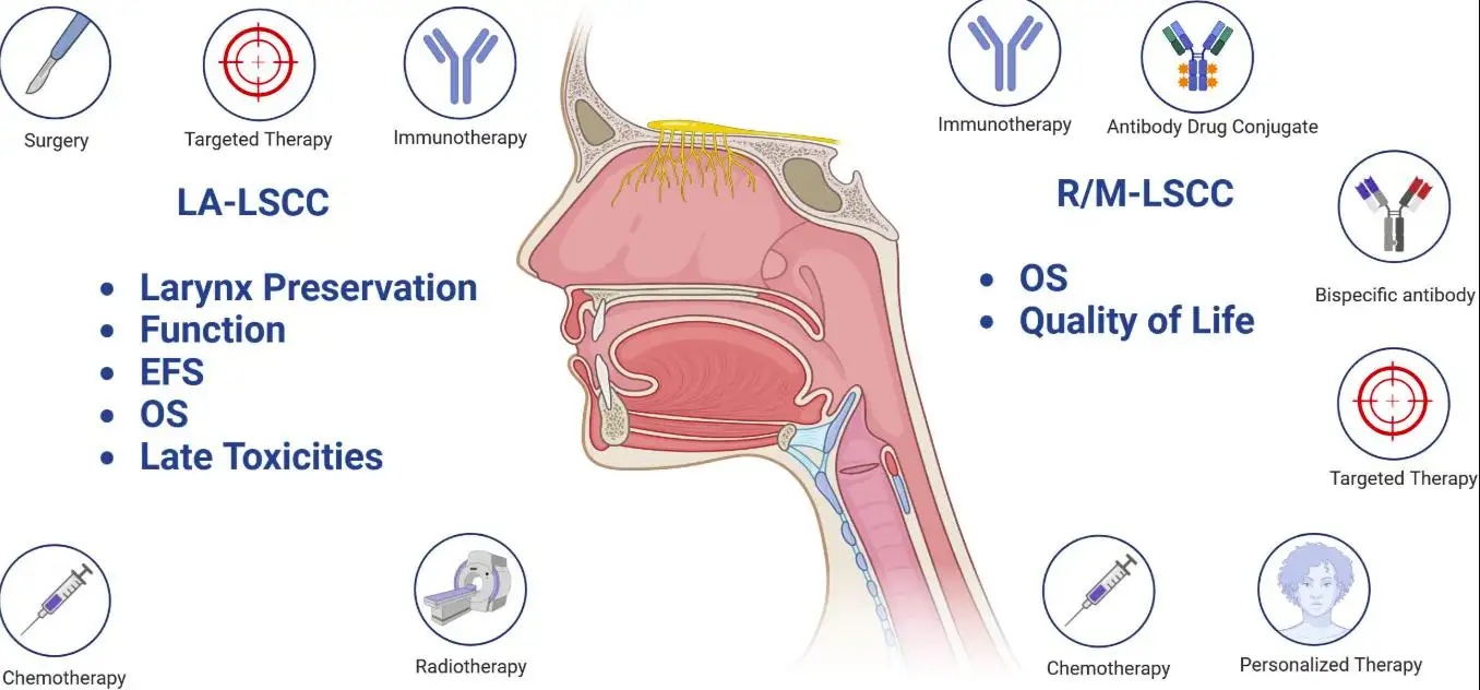 Larynx Cancer Treatment: Options & Recovery 2026