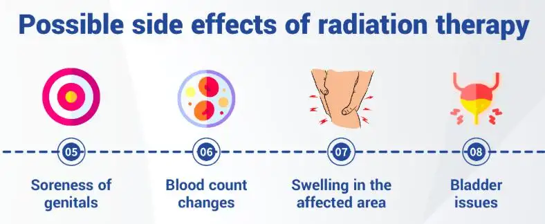 Side Effects of Radiation Therapy for Prostate Cancer: Symptoms, and Management