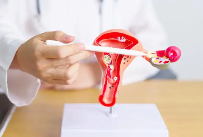 Stage 3 Ovarian Cancer Treatment: Comprehensive Guide to Options, Prognosis