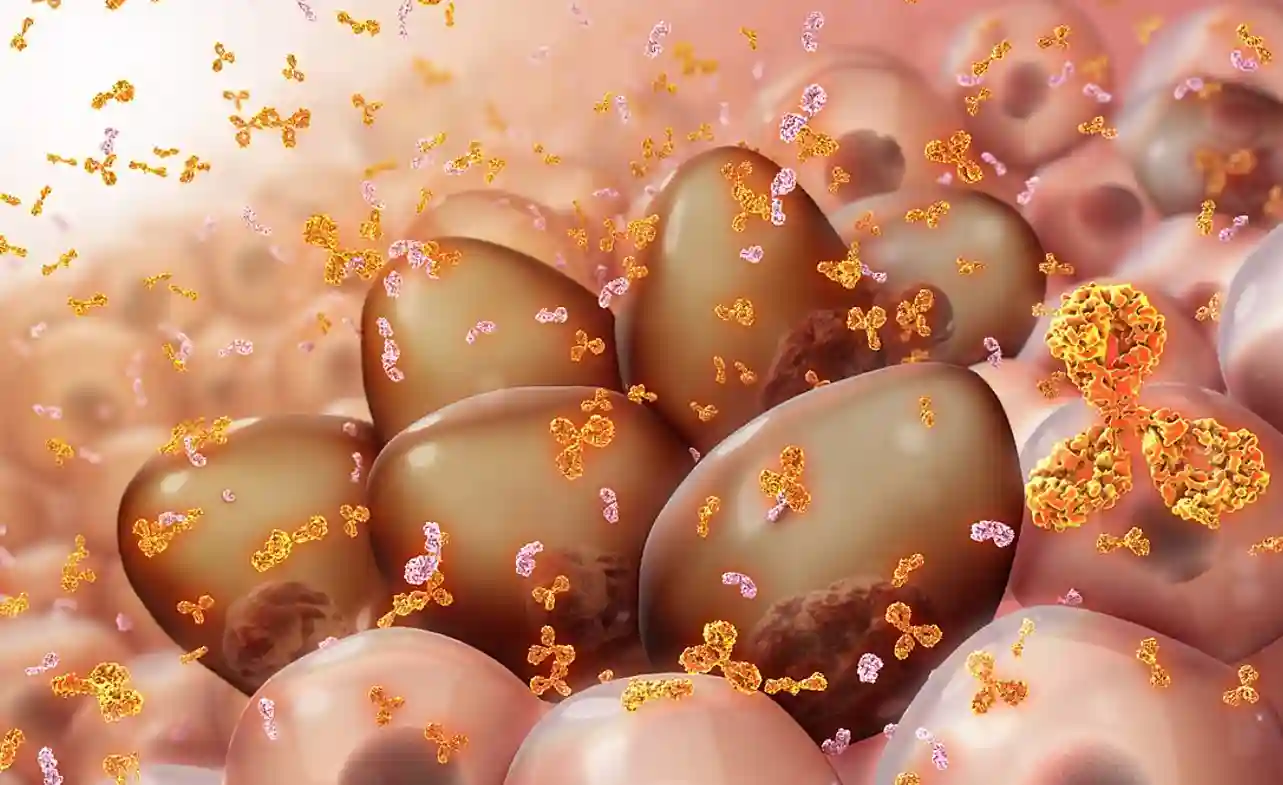 Stem Cell Transplant for Multiple Myeloma Life Expectancy