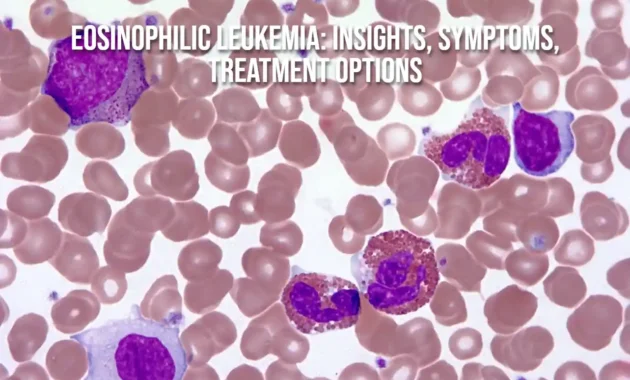 Eosinophilic Leukemia