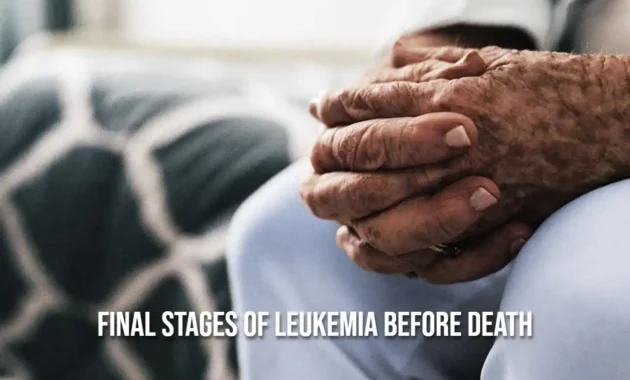 Final Stages of Leukemia Before Death