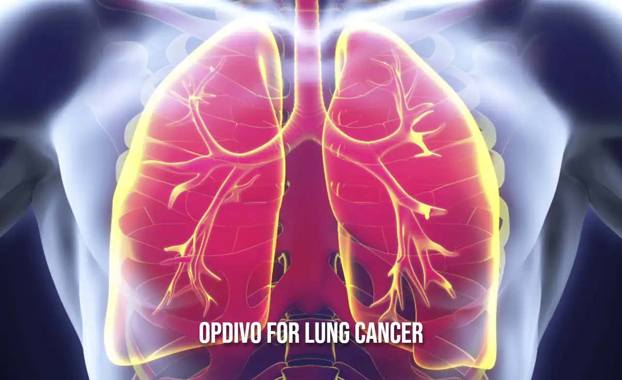 Opdivo for Lung Cancer