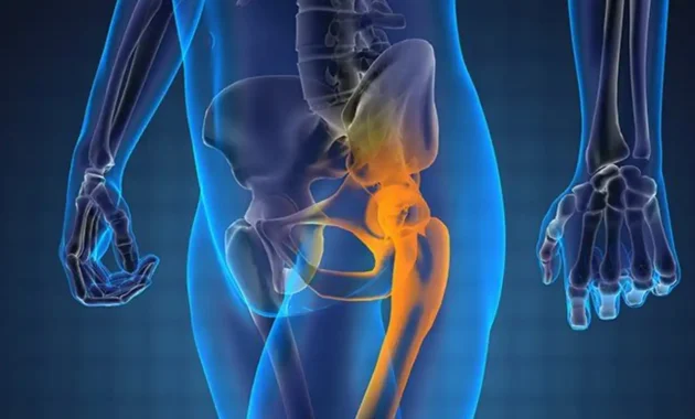 Prostate Cancer Spread to Bones