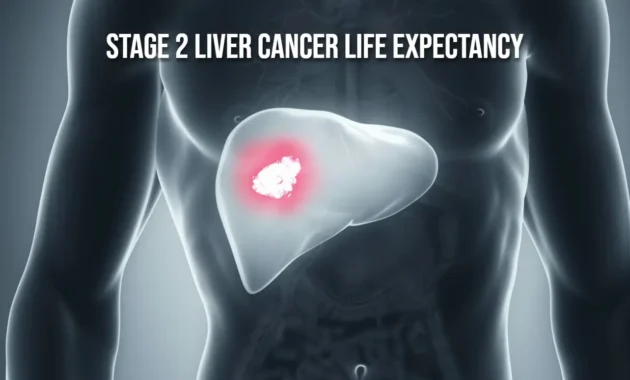 Stage 2 Liver Cancer Life Expectancy