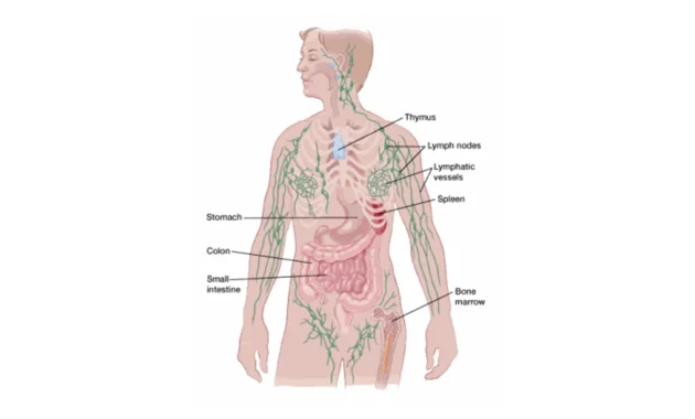 Stage 4 Cancer Lymph Nodes