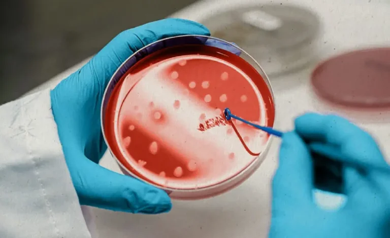 Stem Cell Therapy for Lung Cancer