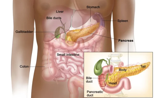 Neuroendocrine Pancreatic Cancer