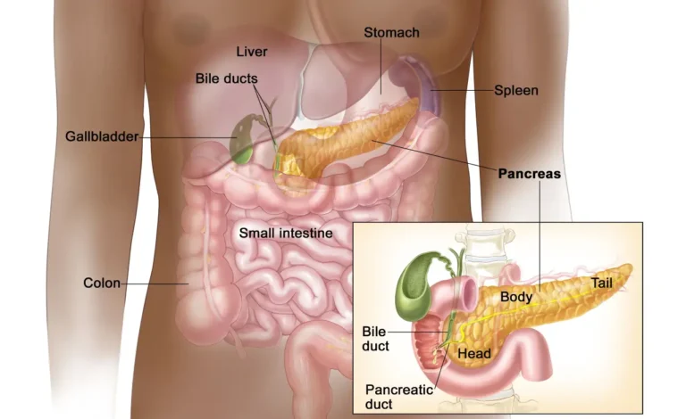 Neuroendocrine Pancreatic Cancer