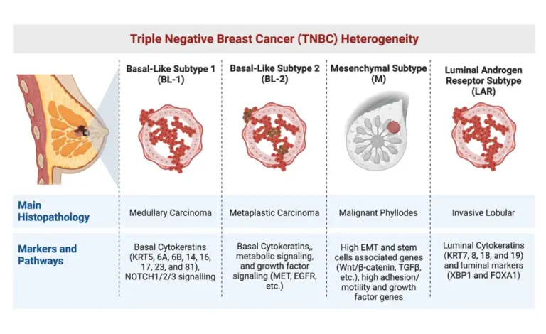 Triple Negative Breast Cancer Metastatic