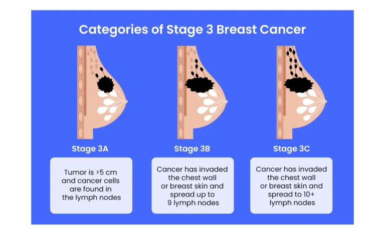 Stage 3 Breast Cancer Recurrence Rate